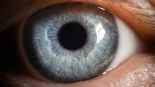olhos azuis, problemas de visão, doenças