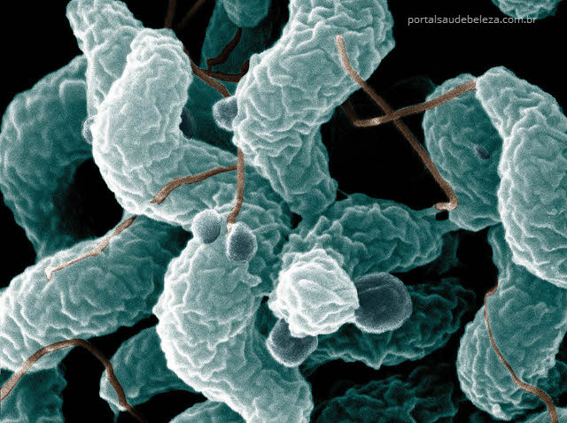 Campylobacter, quais sintomas e tratamento para a infecção?