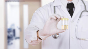 Médico de jaleco segurano potinho com urina para exame